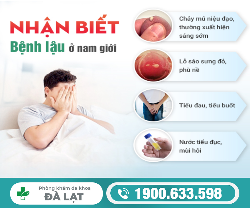 Hình ảnh minh họa